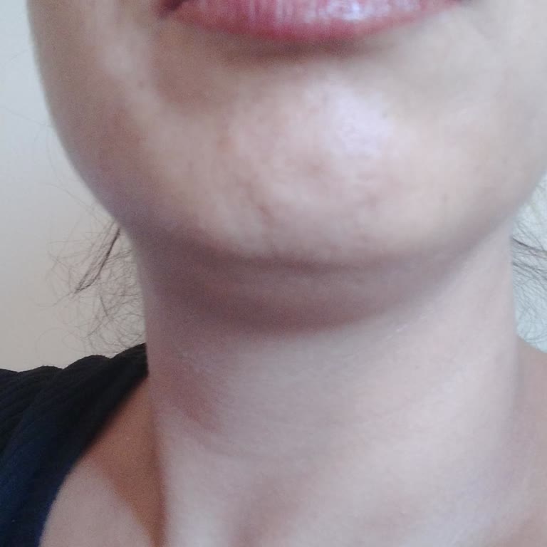 Elegan Estetik Kalıcı Makyaj Memnuniyetsizliği!