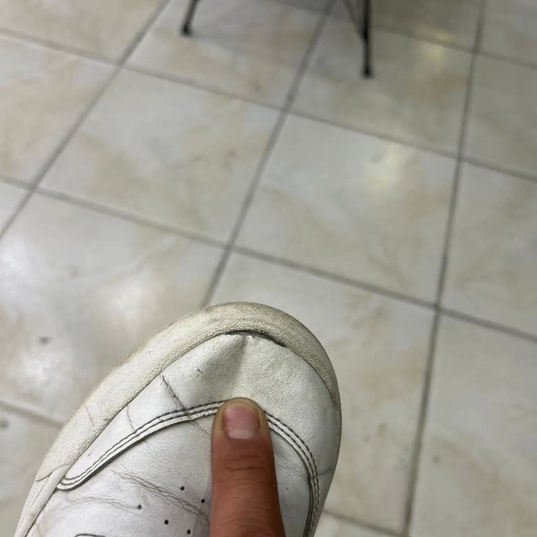 Puma Ayakkabının Önü Açıldı