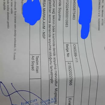 Nike Air Force 1 Mid '07 Ayakkabıda 2 Saatte Deri Soyulması Ve İade Sorunu