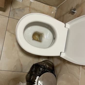 Bursa Kebap Evi Hijyen Sorunlarıyla Karşılaştığım Restoran Deneyimi