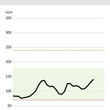 Abbott Freestyle Libre Glikoz Ölçüm Hatası!