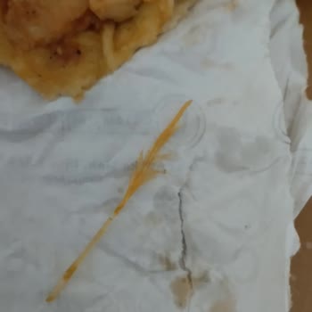 Canikkuşu Restoran Dönerden Çıkan Tavuk Tüyü!