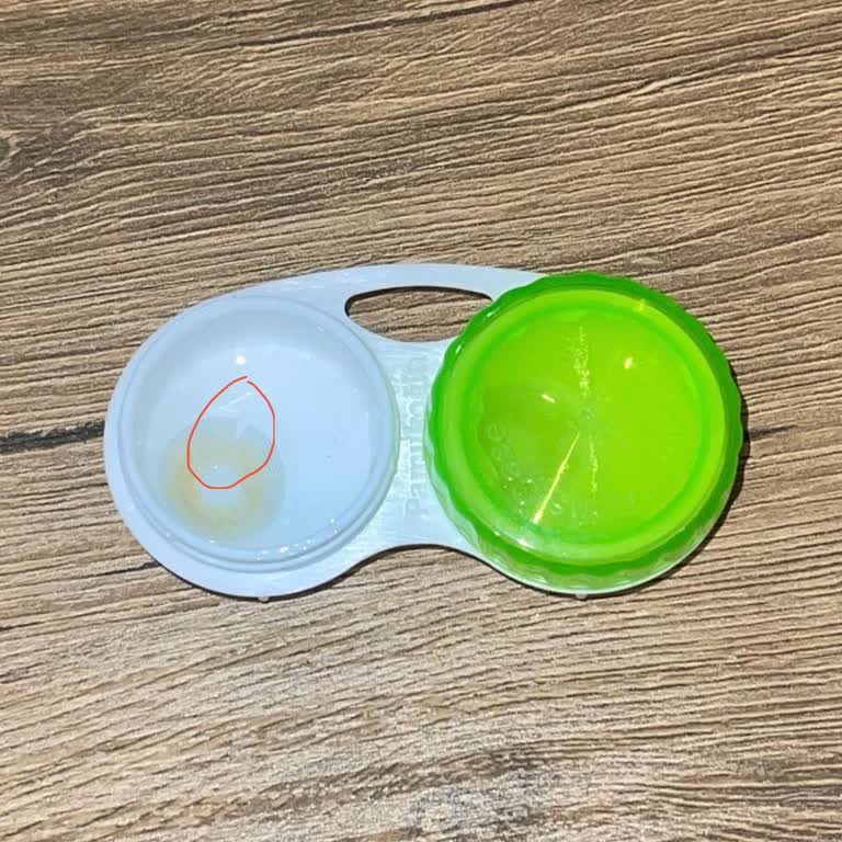 Luxe Optik/elamore Markalı Lensler Asla Kaliteli Değil👎🏻 Yırtılıyor