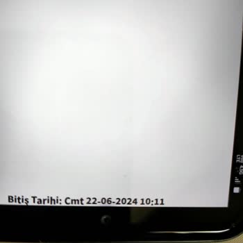 Freestyle Libre Sensör Değişimi Sorunu