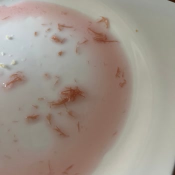 Fanta Nın İçinden Ne Olduğu Belli Olmayan Şeyler Çıktı