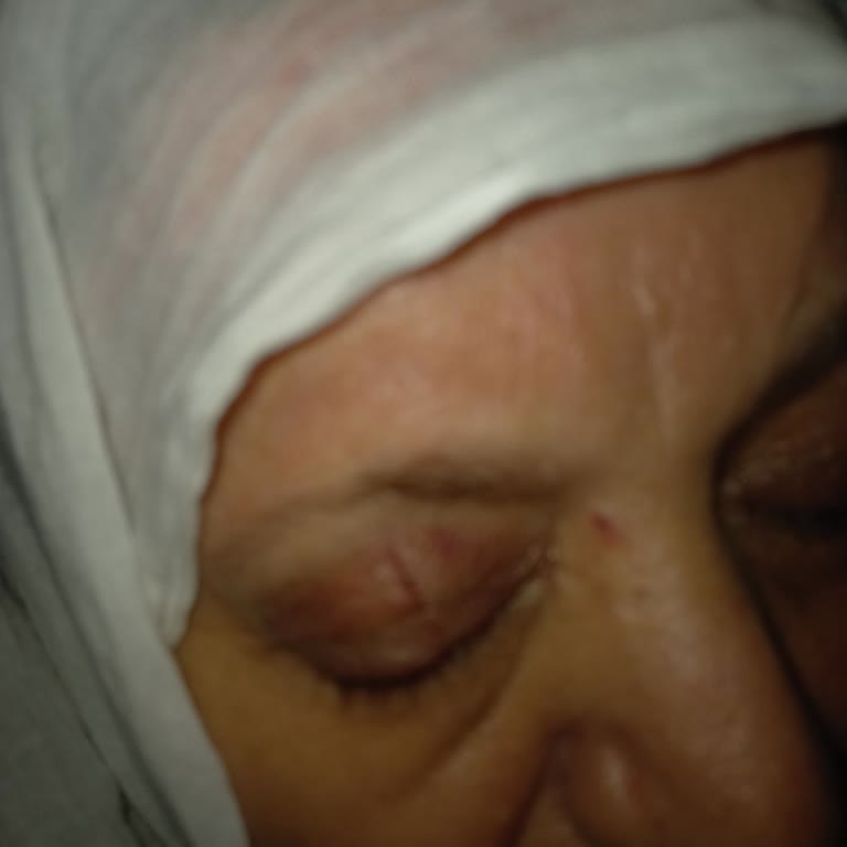 Beypazarı Maden Suyu Patlayan Limonlu Soda: Annemin Yaralanmasına Sebep Oldu