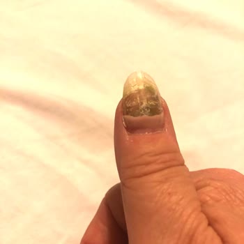 Anis Tırnak Dizayn Antalya Kalitesiz Hizmet