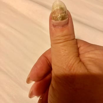 Anis Tırnak Dizayn Antalya Kalitesiz Hizmet