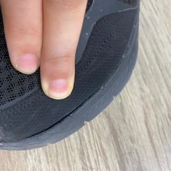 Skechers Mağazasından Cevap Bekleyen Kusurlu Ayakkabı Sorunu!