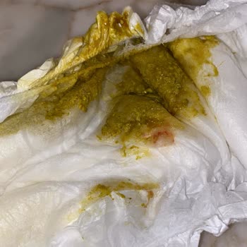 Aptamil 3 Numara Gaitada Kan!