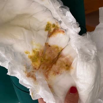 Aptamil 3 Numara Gaitada Kan!