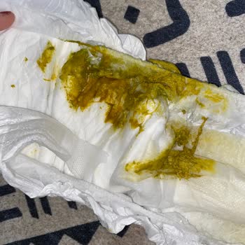 Aptamil 3 Numara Gaitada Kan!