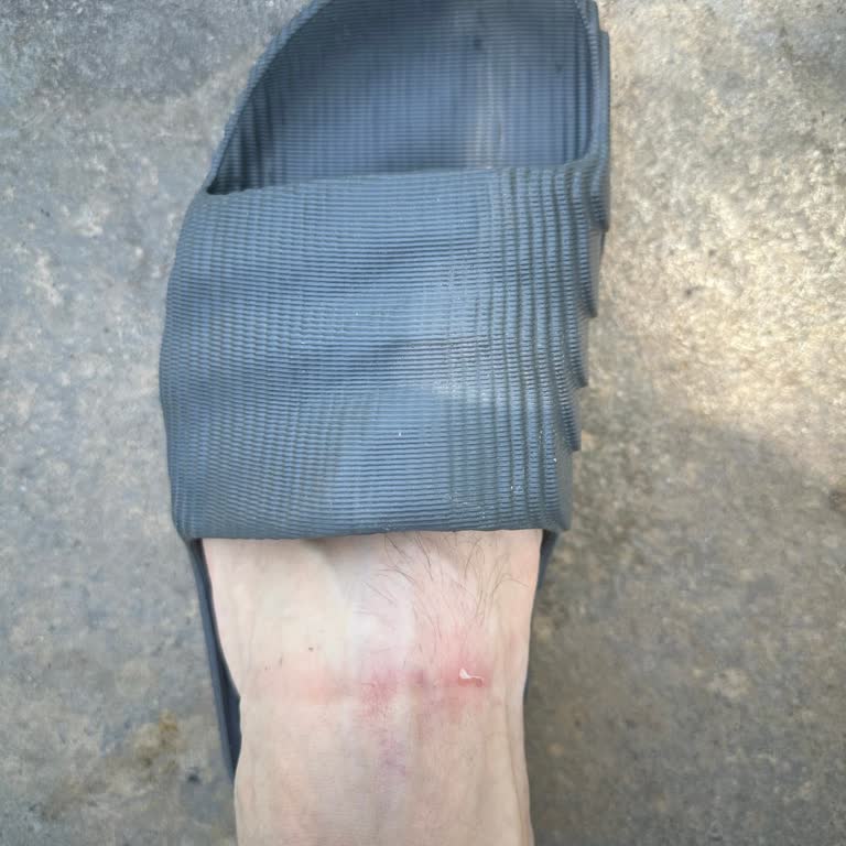 Adidas Adilette 22 Terlik