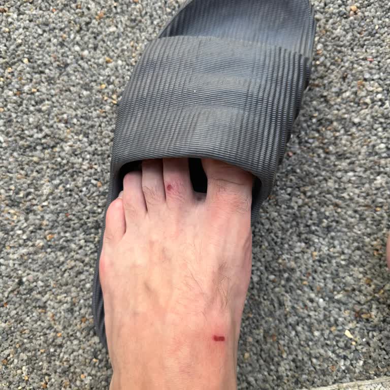 Adidas Adilette 22 Terlik