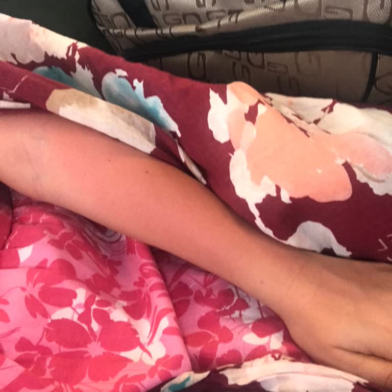 Eda Taşpınar Bronzlaştırıcı Cildimi Haşlama Yaptı