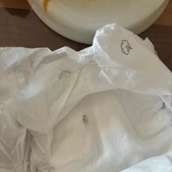 Sleepy Yenidoğan Bezinde Böcek Ölüsü Çıktı