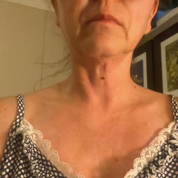 İbrahim Etem İlaç Croxilex Antibiyotik Kullanımı