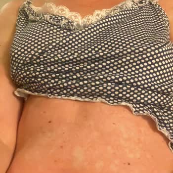 İbrahim Etem İlaç Croxilex Antibiyotik Kullanımı