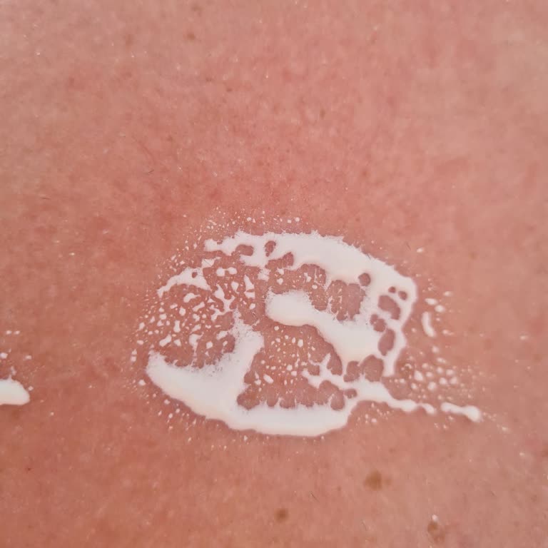 Nivea 50+ Güneş Kremi Sahte Ürün Satışı
