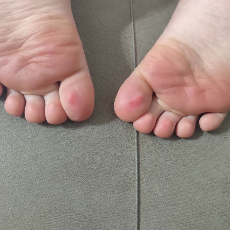 Ankara Keçiören Kartaltepe Aquapark Pişmanlıktır