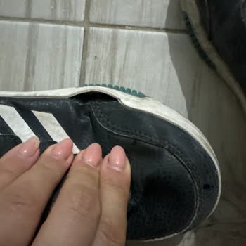 adidas Ürünlerde Yanlarda Patlama Deri Soyulması