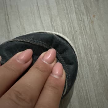 adidas Ürünlerde Yanlarda Patlama Deri Soyulması