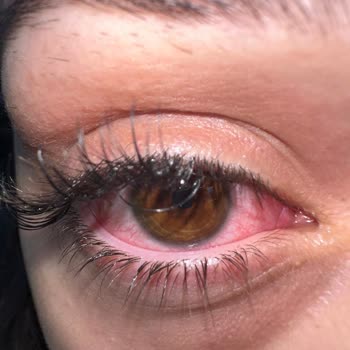 Zeynep Çam Güzellik Ve Bakım İpek Kirpik Şikayeti