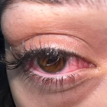 Zeynep Çam Güzellik Ve Bakım İpek Kirpik Şikayeti