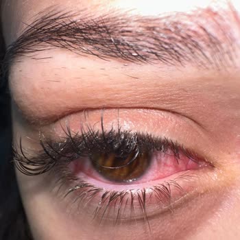 Zeynep Çam Güzellik Ve Bakım İpek Kirpik Şikayeti