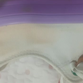 Benetton Beyaz Ayakkabılarında Renk Bozulması Yaşanıyor Bilginiz Olsun