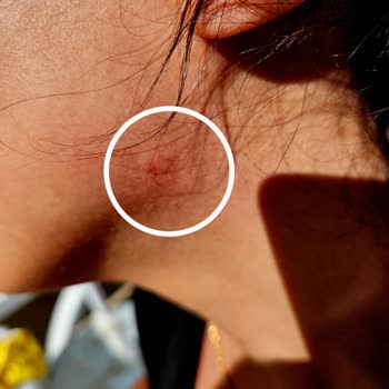 Ladonia Hotels Adakule Can Güvenliği Sıkıntısı