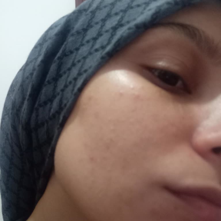 The Purest Solutions The Purest Şikayet