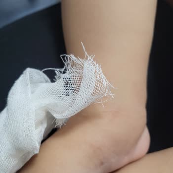 Medicana Hospitals Acil Servis Bebek Hasta