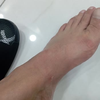 Deichmann Ürün Hatası Var Ama Mağaza Nasıl Bir İnceleme Yaptı İse Hata Yookk