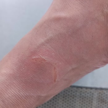 Deichmann Ürün Hatası Var Ama Mağaza Nasıl Bir İnceleme Yaptı İse Hata Yookk