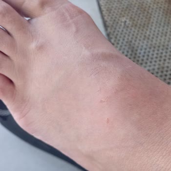 Deichmann Ürün Hatası Var Ama Mağaza Nasıl Bir İnceleme Yaptı İse Hata Yookk