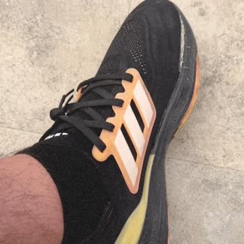Adidas Ayakkabı Pişmanlıktır Ürün Kusurlu Çıkarsa Elinizde Kalır