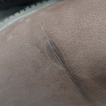 Tamer Tanca 1 Haftada Eriyen Bot Hk