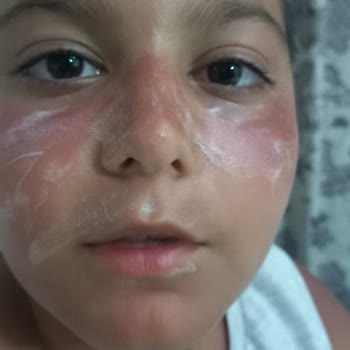 Dear Body Güneş Kremleri Şikayeti