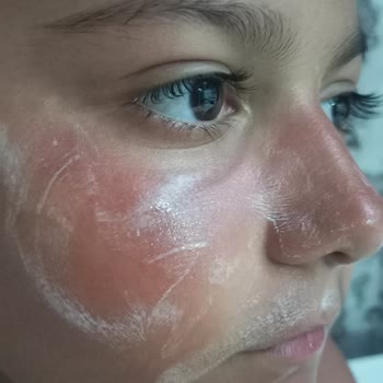 Dear Body Güneş Kremleri Şikayeti