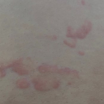 Dragut Point Hotel Tam Bir Sıkıntı