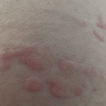 Dragut Point Hotel Tam Bir Sıkıntı