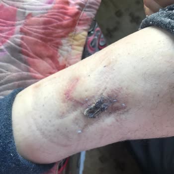 Çorum Belediyesi Başıboş Köpek Sorunu!