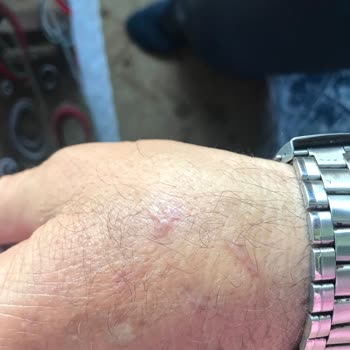 Çorum Belediyesi Başıboş Köpek Sorunu!