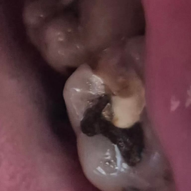 Huzur Tıp Merkezi Özel Tıp Merkezinde Yaşanan Tedavi Sorunları