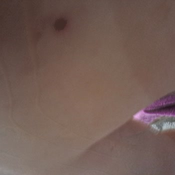 Samsung Telefon Galaxy A33 5G Telefonumda Fotoğraf Yakınlaştırma Ve Netlik Sorunu.