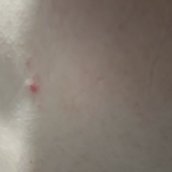 Samsung Telefon Galaxy A33 5G Telefonumda Fotoğraf Yakınlaştırma Ve Netlik Sorunu.