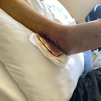 Villa Kalkan Sağlık'tan Dolayı İptal İstenmesi