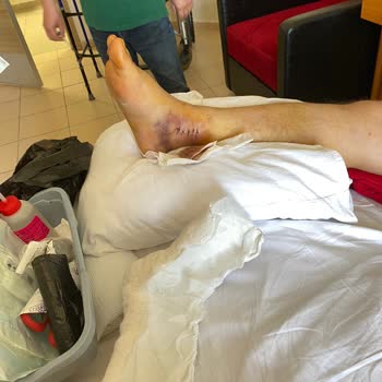 Villa Kalkan Sağlık'tan Dolayı İptal İstenmesi