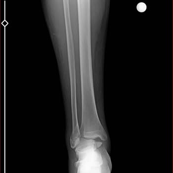 Villa Kalkan Sağlık'tan Dolayı İptal İstenmesi